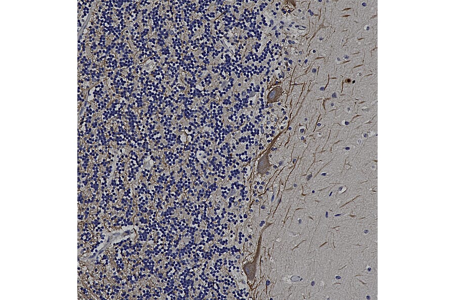 Immunohistochemistry - Anti-NF-M Antibody (A85323) - Antibodies.com