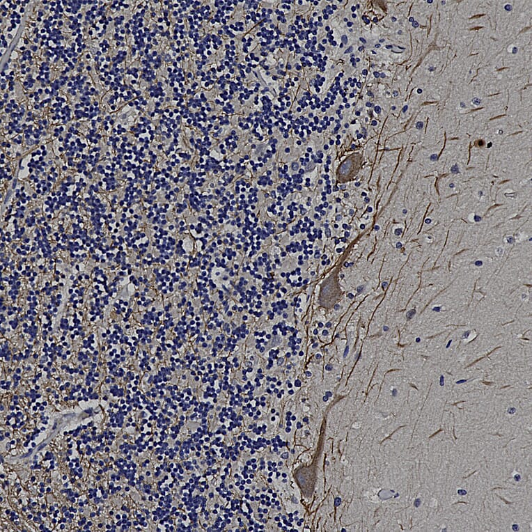 Immunohistochemistry - Anti-NF-M Antibody (A85323) - Antibodies.com
