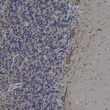Immunohistochemistry - Anti-NF-M Antibody (A85323) - Antibodies.com
