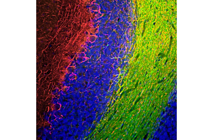 Immunofluorescence - Anti-NF-M Antibody (A85324) - Antibodies.com