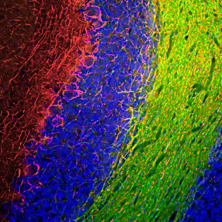 Immunofluorescence - Anti-NF-M Antibody (A85324) - Antibodies.com