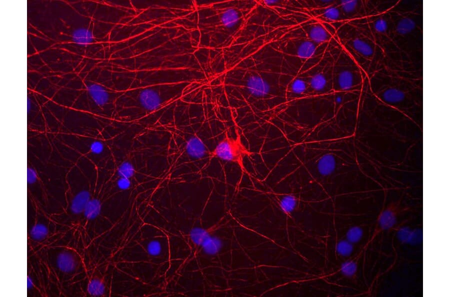 Immunofluorescence - Anti-NF-M Antibody (A85324) - Antibodies.com