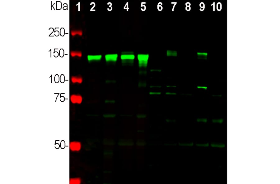 Western Blot - Anti-NF-M Antibody (A85324) - Antibodies.com