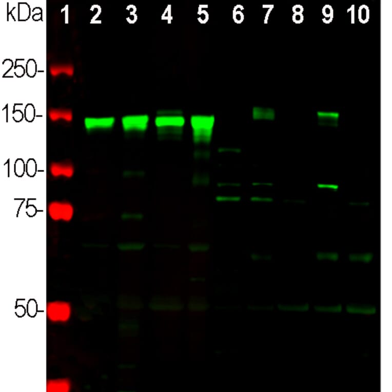 Western Blot - Anti-NF-M Antibody (A85324) - Antibodies.com