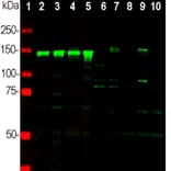 Western Blot - Anti-NF-M Antibody (A85324) - Antibodies.com