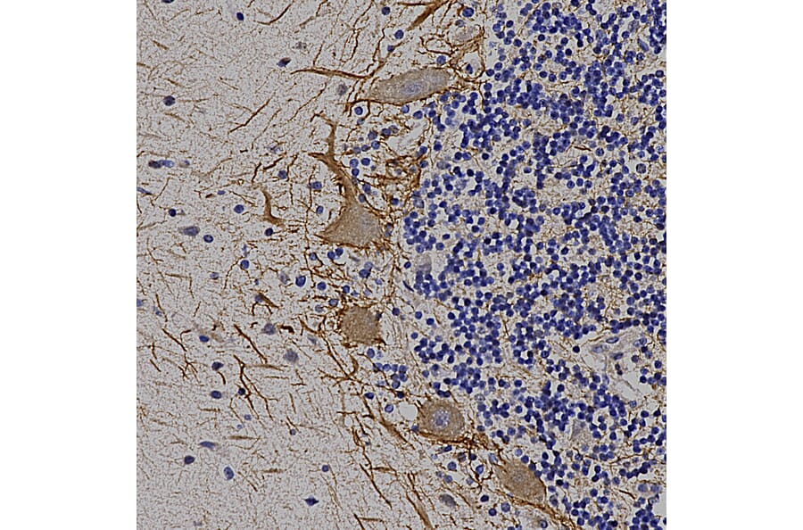 Immunohistochemistry - Anti-NF-M Antibody (A85324) - Antibodies.com