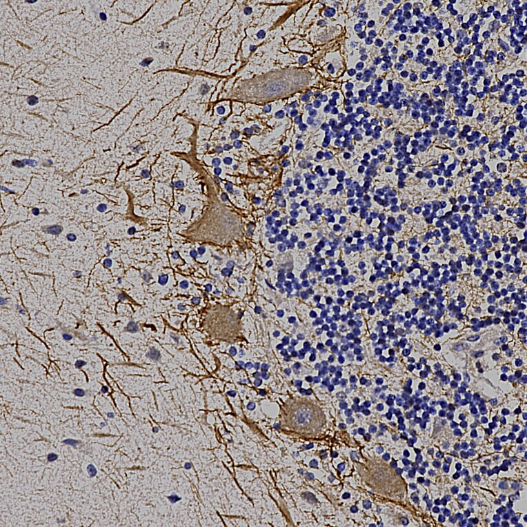 Immunohistochemistry - Anti-NF-M Antibody (A85324) - Antibodies.com