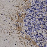 Immunohistochemistry - Anti-NF-M Antibody (A85324) - Antibodies.com