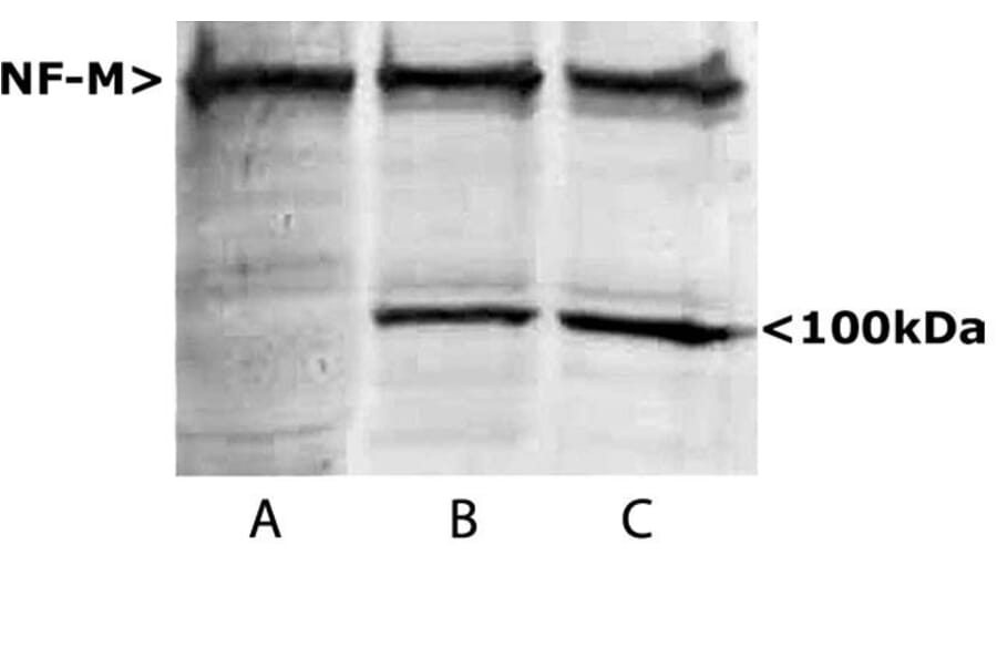 Western Blot - Anti-NF-M Antibody (A85324) - Antibodies.com
