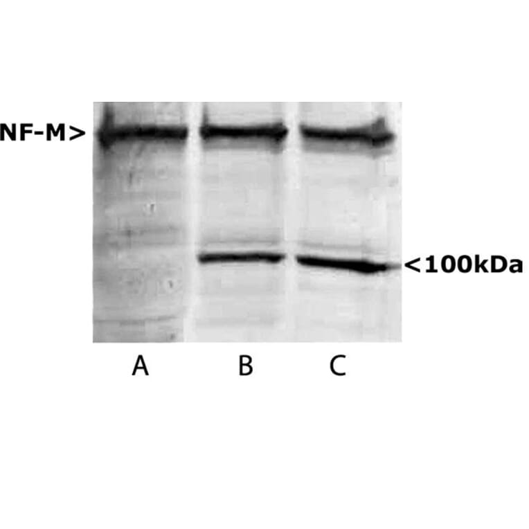 Western Blot - Anti-NF-M Antibody (A85324) - Antibodies.com