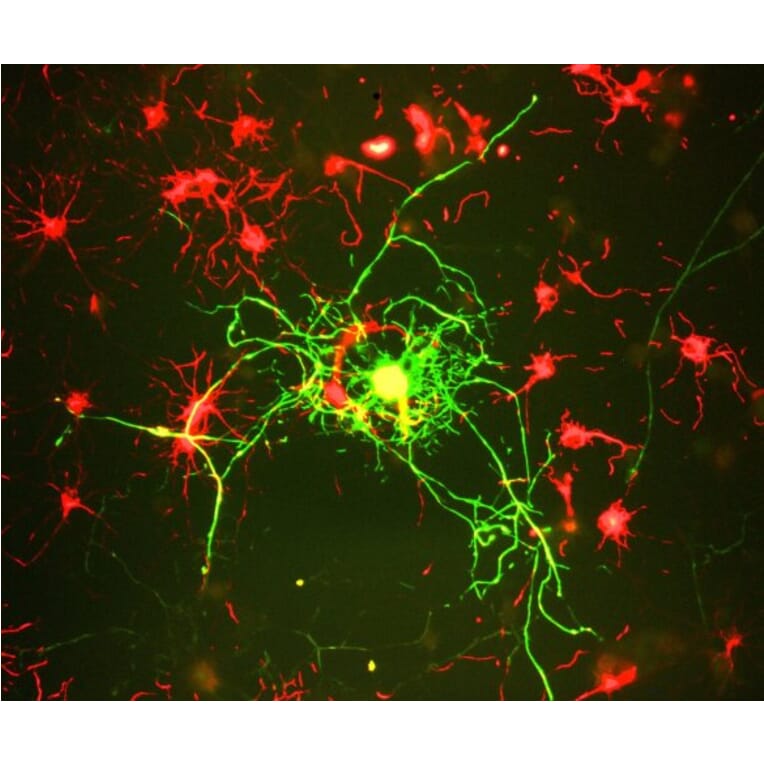 Immunofluorescence - Anti-NF-M Antibody [3H11] (A85325) - Antibodies.com