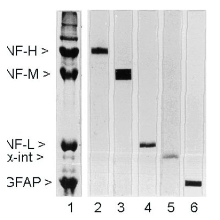 Western Blot - Anti-NF-M Antibody [3H11] (A85325) - Antibodies.com