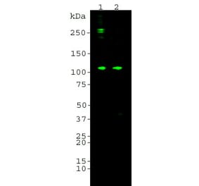 Western Blot - Anti-a Subunit Of Complement Component 6 Antibody (A85330) - Antibodies.com