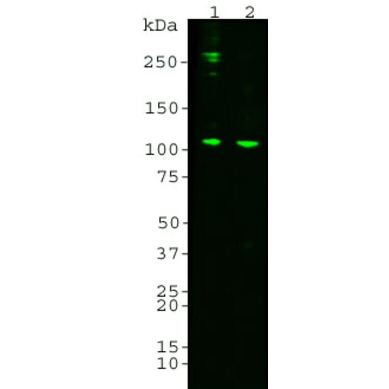 Western Blot - Anti-Complement C3 alpha chain Antibody [2B5] (A85332) - Antibodies.com