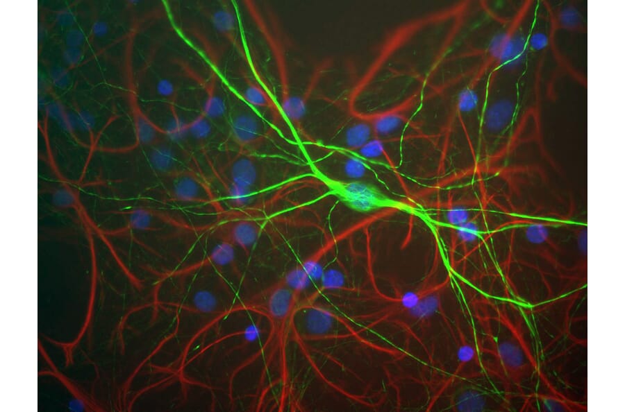 Immunofluorescence - Anti-NF-H Antibody (A85335) - Antibodies.com