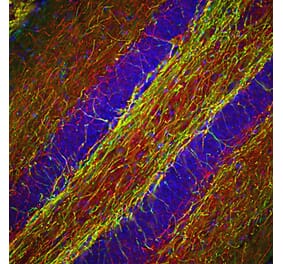 Immunofluorescence - Anti-NF-H Antibody (A85336) - Antibodies.com