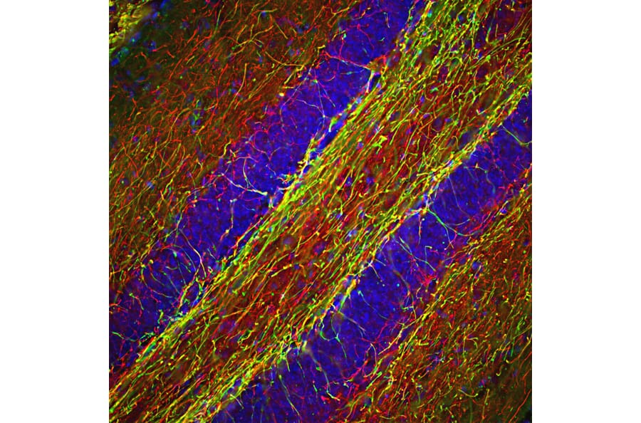 Immunofluorescence - Anti-NF-H Antibody (A85336) - Antibodies.com
