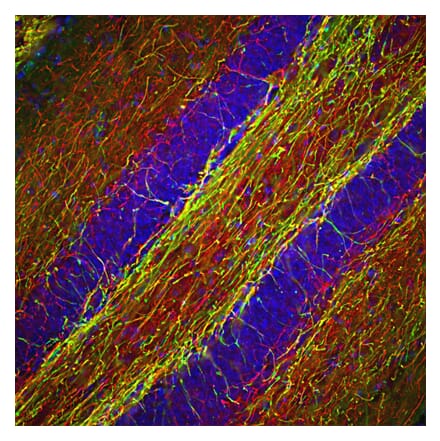 Immunofluorescence - Anti-NF-H Antibody (A85336) - Antibodies.com