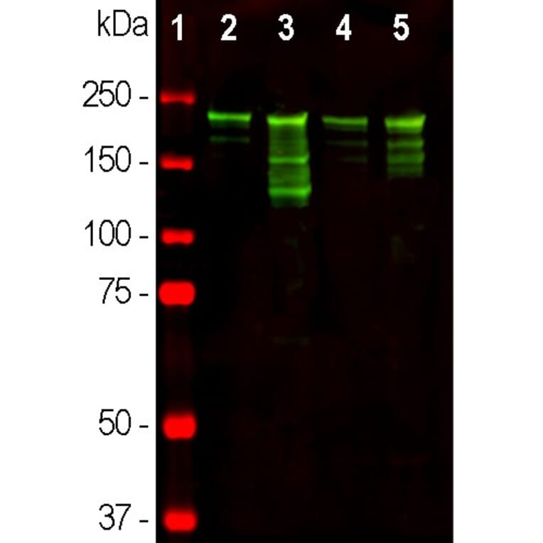 Western Blot - Anti-NF-H Antibody (A85336) - Antibodies.com