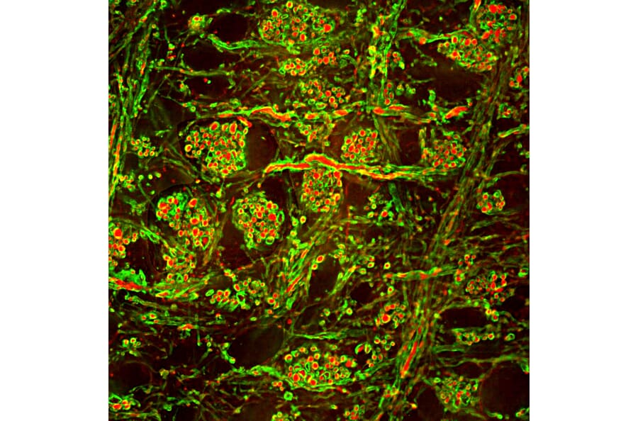 Immunofluorescence - Anti-NF-H Antibody (A85336) - Antibodies.com