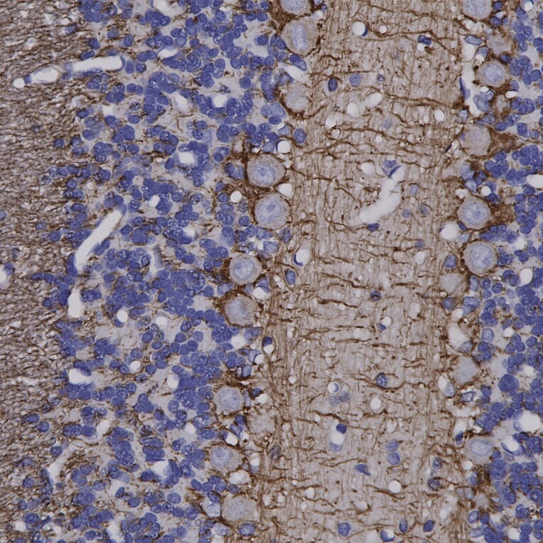 Immunohistochemistry - Anti-NF-H Antibody (A85336) - Antibodies.com