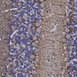 Immunohistochemistry - Anti-NF-H Antibody (A85336) - Antibodies.com