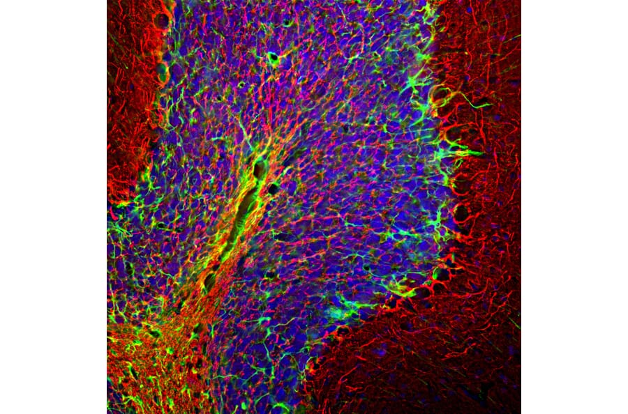 Immunofluorescence - Anti-NF-H Antibody (A85337) - Antibodies.com