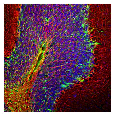 Immunofluorescence - Anti-NF-H Antibody (A85337) - Antibodies.com