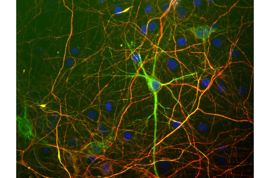 Immunofluorescence - Anti-NF-H Antibody (A85337) - Antibodies.com