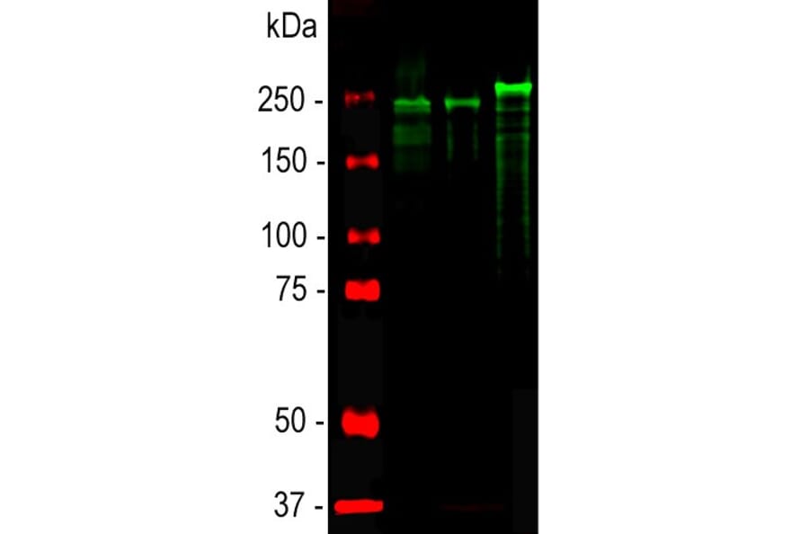 Western Blot - Anti-NF-H Antibody (A85337) - Antibodies.com
