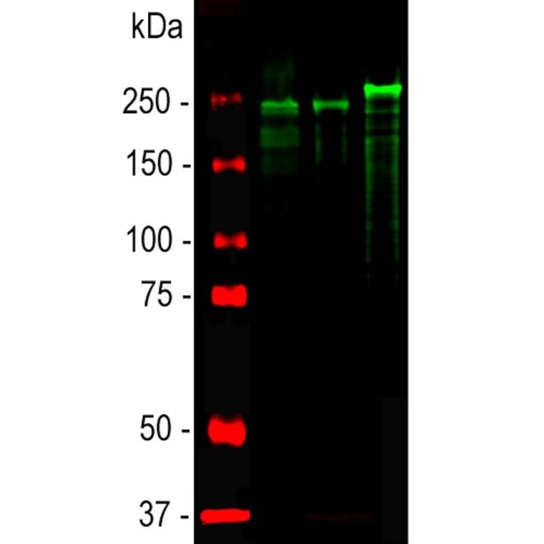Western Blot - Anti-NF-H Antibody (A85337) - Antibodies.com