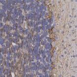 Immunohistochemistry - Anti-NF-H Antibody (A85337) - Antibodies.com