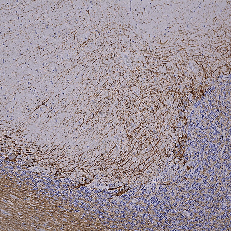 Immunohistochemistry - Anti-NF-H Antibody [NAP4] (A85339) - Antibodies.com