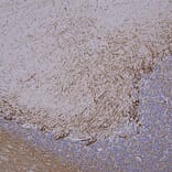 Immunohistochemistry - Anti-NF-H Antibody [NAP4] (A85339) - Antibodies.com