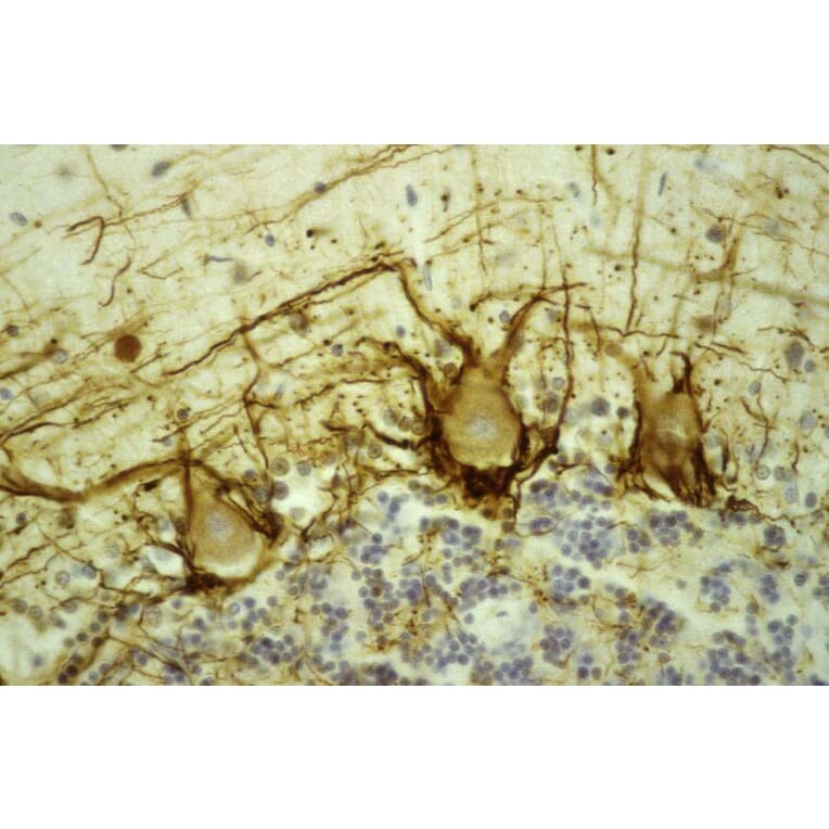 Immunofluorescence - Anti-NF-H Antibody [NAP4] (A85339) - Antibodies.com