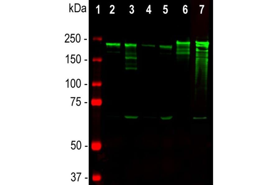 Western Blot - Anti-NF-H Antibody [NAP4] (A85339) - Antibodies.com