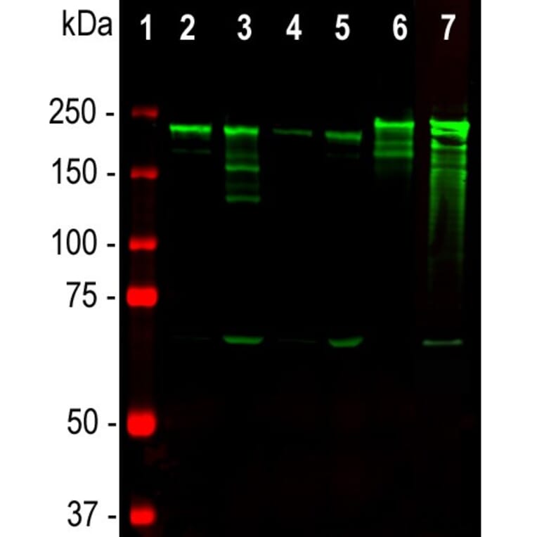 Western Blot - Anti-NF-H Antibody [NAP4] (A85339) - Antibodies.com