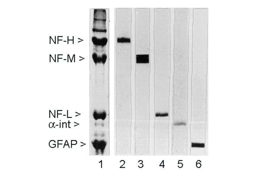 Western Blot - Anti-NF-H Antibody [NAP4] (A85339) - Antibodies.com