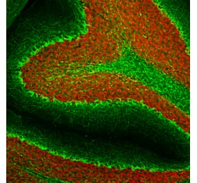 Immunohistochemistry - Anti-Neurofilament Heavy Polypeptide Antibody [AH1] (A85340) - Antibodies.com