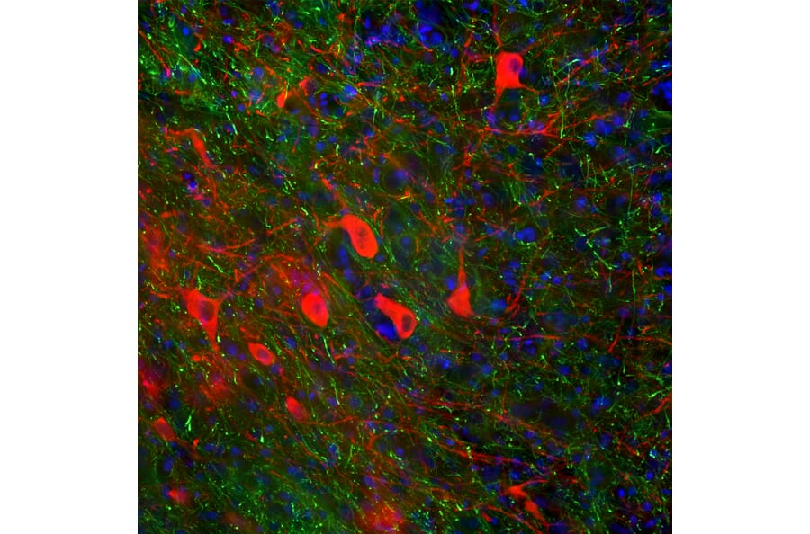 Immunofluorescence - Anti-NF-H Antibody [AH1] (A85340) - Antibodies.com