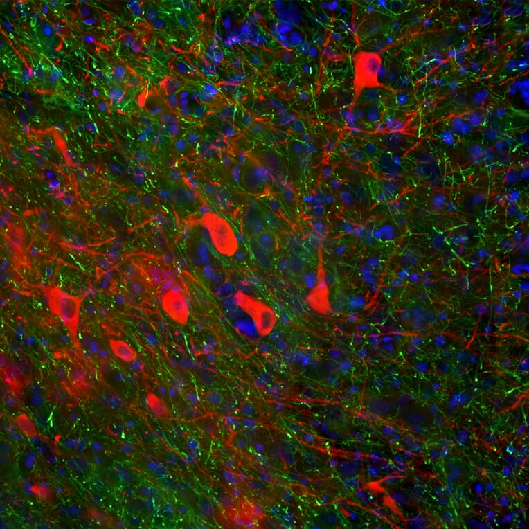 Immunofluorescence - Anti-NF-H Antibody [AH1] (A85340) - Antibodies.com
