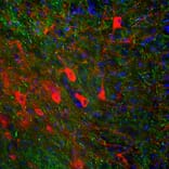 Immunofluorescence - Anti-NF-H Antibody [AH1] (A85340) - Antibodies.com