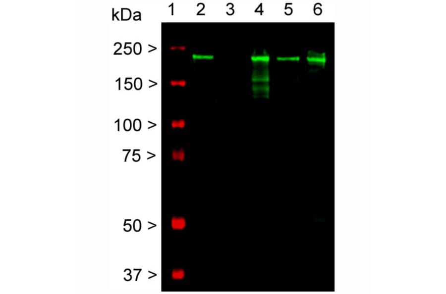 Western Blot - Anti-NF-H Antibody [AH1] (A85340) - Antibodies.com