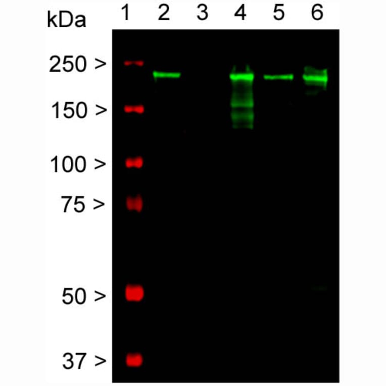 Western Blot - Anti-NF-H Antibody [AH1] (A85340) - Antibodies.com