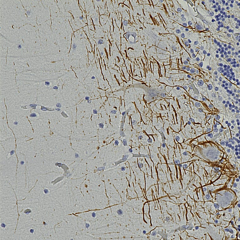 Immunohistochemistry - Anti-NF-H Antibody [AH1] (A85340) - Antibodies.com