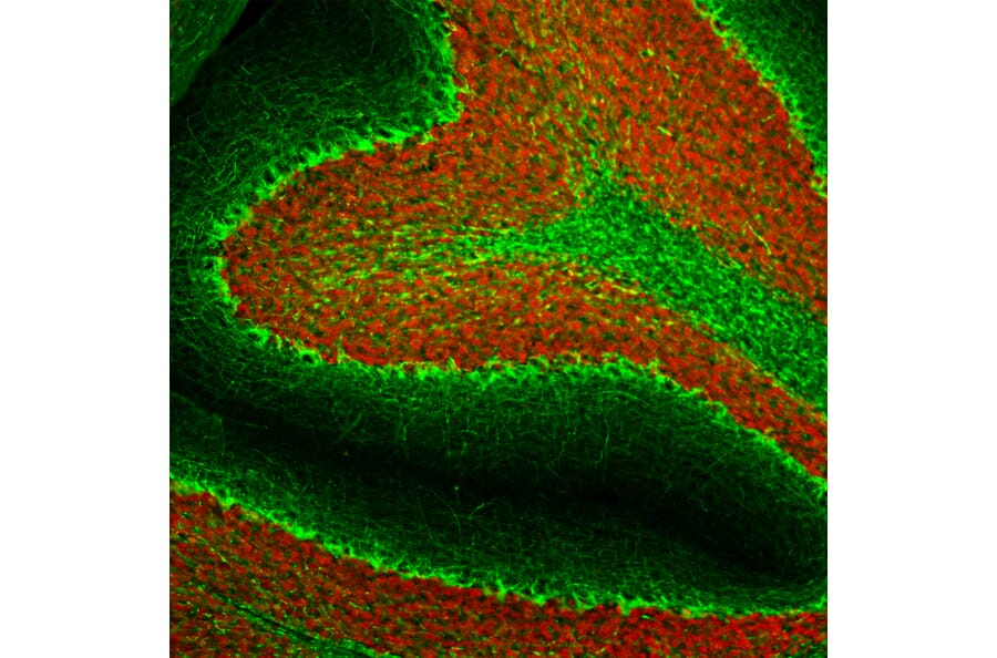 Immunohistochemistry - Anti-NF-H Antibody [AH1] (A85340) - Antibodies.com