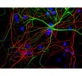 Immunofluorescence - Anti-NF-H Antibody (A85341) - Antibodies.com