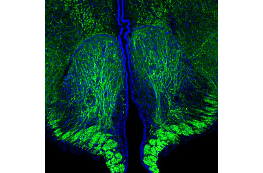 Immunofluorescence - Anti-NF-H Antibody [9B12] (A85341) - Antibodies.com