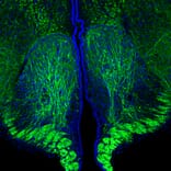 Immunofluorescence - Anti-NF-H Antibody [9B12] (A85341) - Antibodies.com