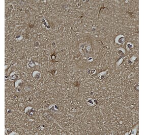 Immunohistochemistry - Anti-DJ1 Antibody [4H4] (A85343) - Antibodies.com